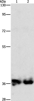 ASPA Antibody