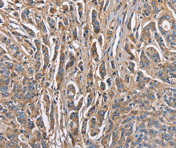 ABI3BP Antibody