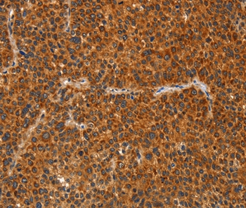 IKZF3 Antibody