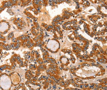 IKZF3 Antibody