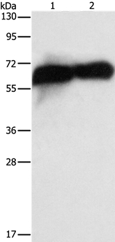 ALPP Antibody