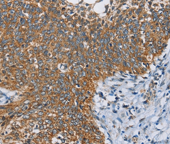 ANKHD1 Antibody