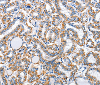 ARL11 Antibody