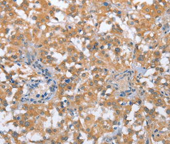 TP53BP2 Antibody