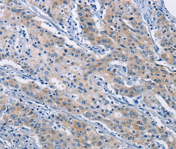 ATP6AP2 Antibody