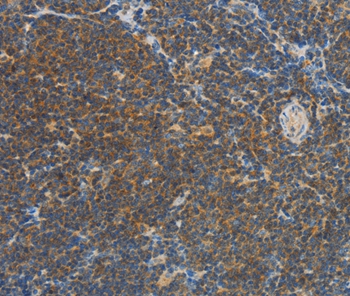 VTCN1 Antibody