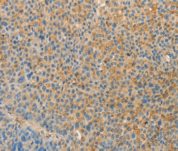 VTCN1 Antibody