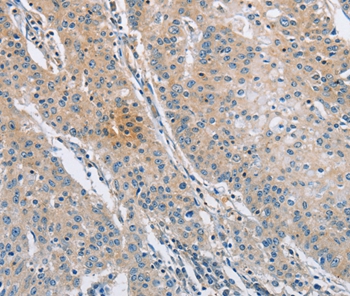 SH3GLB1 Antibody