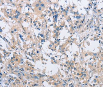 SH3GLB1 Antibody