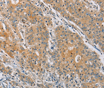 KCNMA1 Antibody