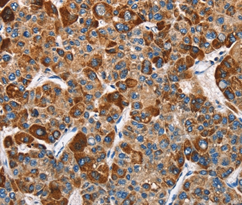 SLAMF8 Antibody