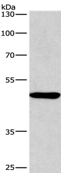 BMP15 Antibody