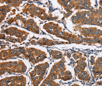 EIF4EBP2 Antibody