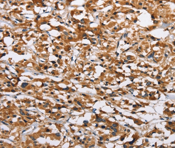 EIF4EBP2 Antibody