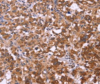 FBXW7 Antibody