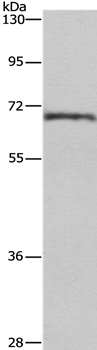 CDK5RAP3 Antibody