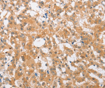 CDKN2C Antibody