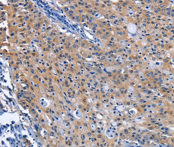 CDO1 Antibody