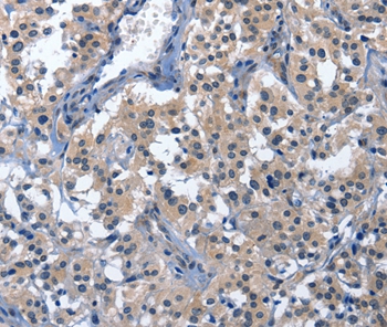 CDO1 Antibody