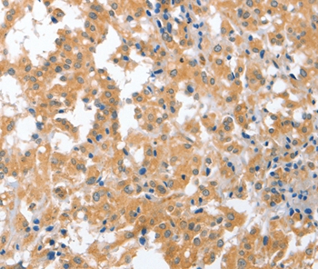 CDR2 Antibody