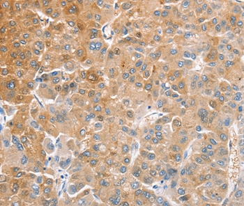 CDR2 Antibody