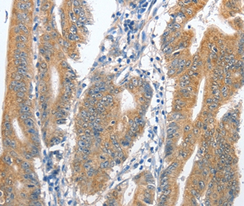 CENPC Antibody