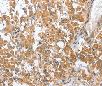 CHMP4B Antibody