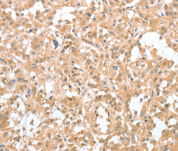 CIAPIN1 Antibody