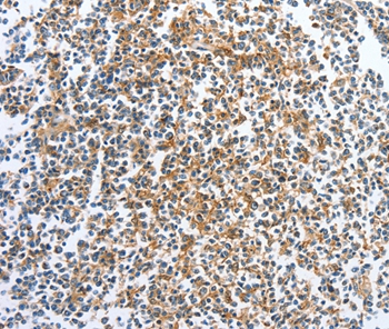 CKAP2 Antibody