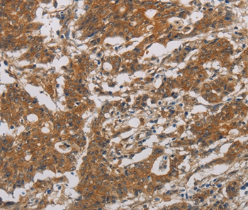 CNDP1 Antibody