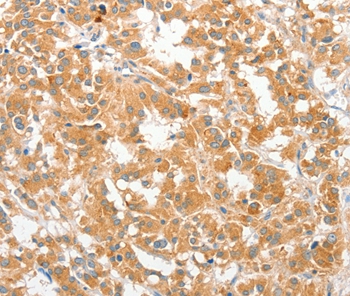 COL4A3BP Antibody