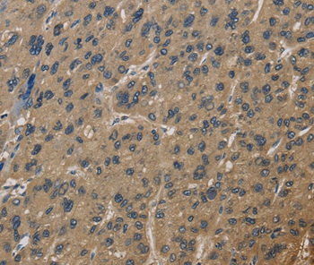 CORO1C Antibody