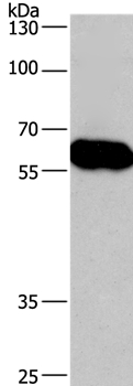 CORO1C Antibody