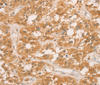 CPB1 Antibody