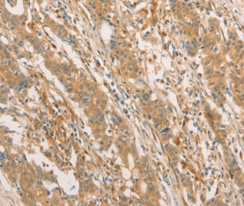 CPB1 Antibody