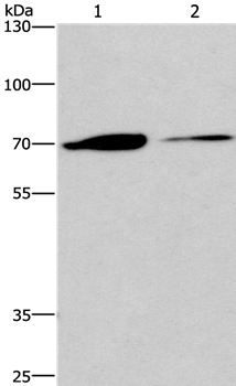 CROT Antibody