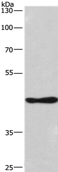 CSNK1D Antibody