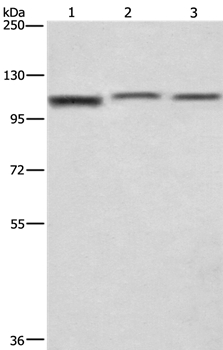 CTAGE5 Antibody