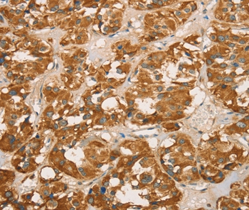 RBBP8 Antibody