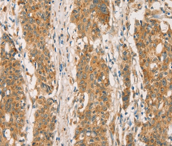 RBBP8 Antibody