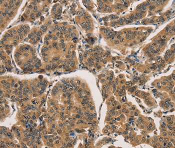 CTNNBIP1 Antibody