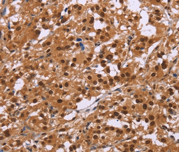 CTNNBL1 Antibody