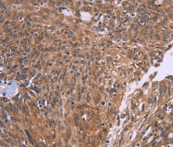 CTNNBL1 Antibody