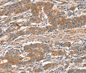 CUEDC2 Antibody