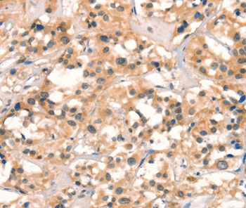 CUEDC2 Antibody