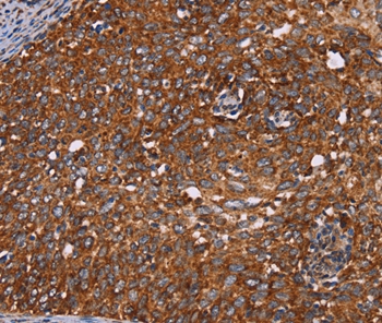 CYP2W1 Antibody