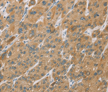 CYP27A1 Antibody