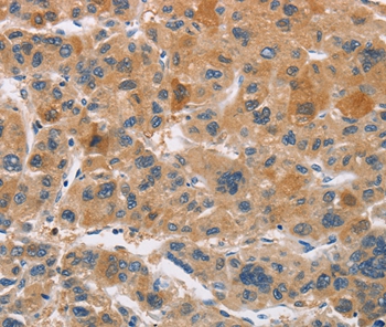 CYP4A11 Antibody