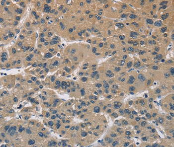 CYR61 Antibody