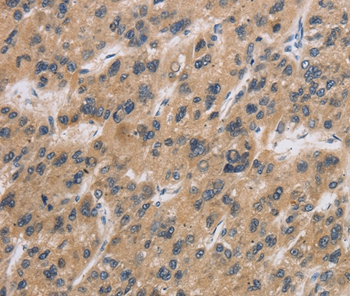 CST6 Antibody